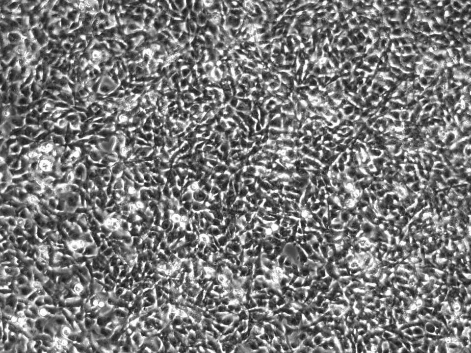 NEPA21 / HTR-8 Svneo - Human Trophoblast cells - Viability 95 per cent